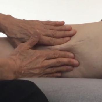 Rolﬁng® and Scars